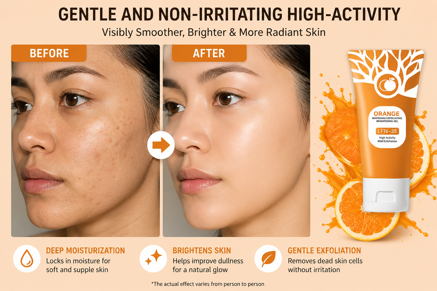 Orange Exfoliating Gel  جل تقشير البرتقال  🔥