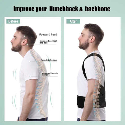 Instant Posture Corrector || مصحح الوضعية الفوري